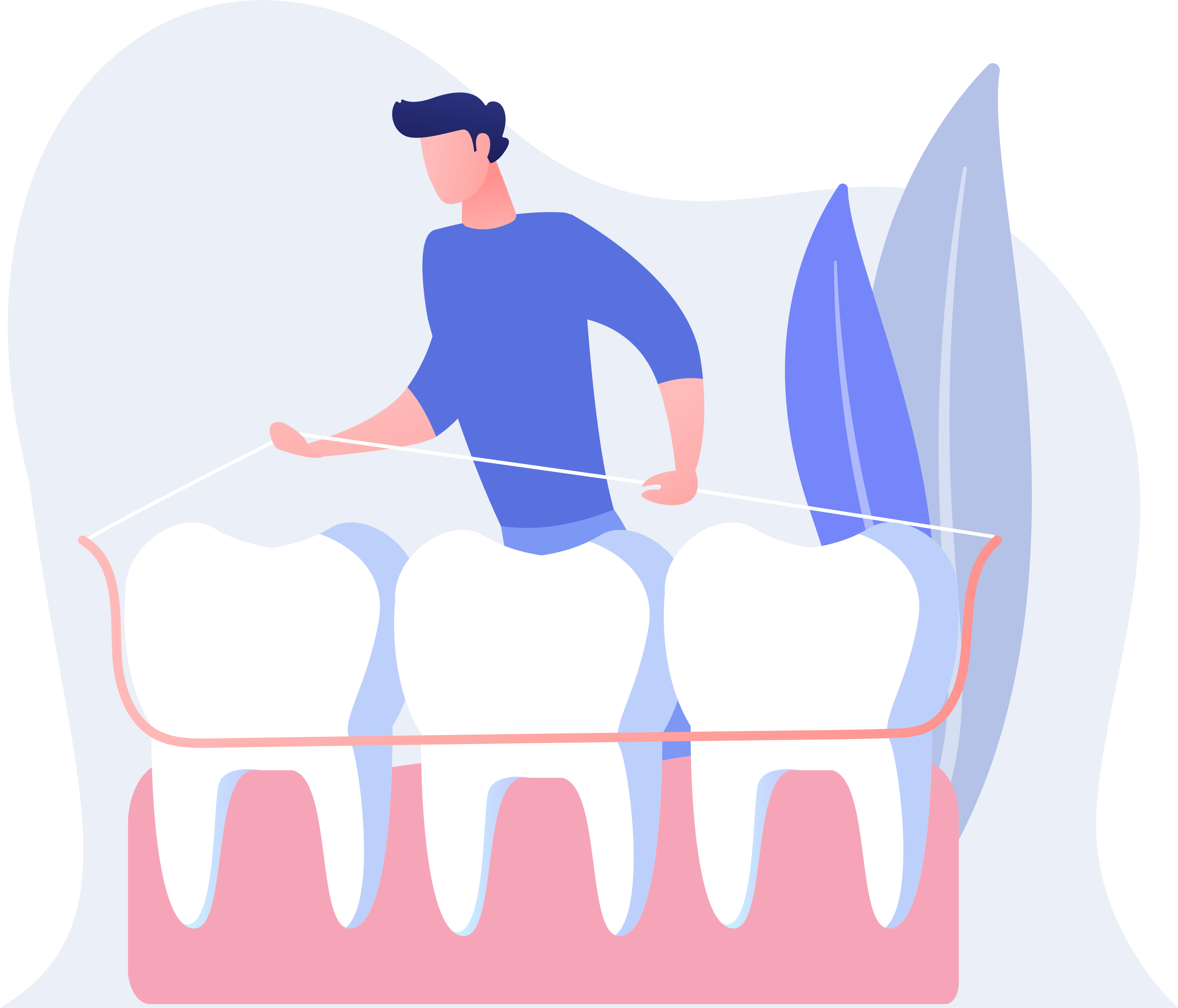 dental-bridges